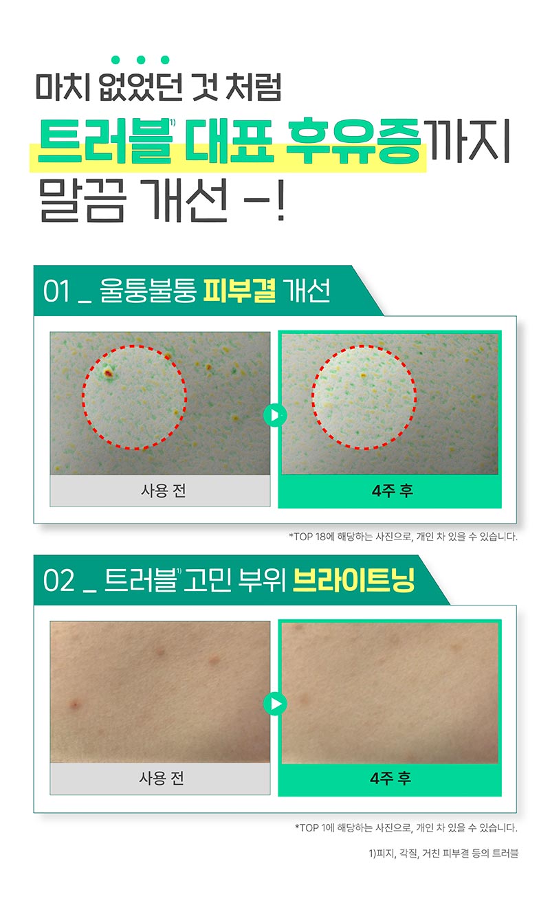 이미지 내 텍스트 내용 삽입