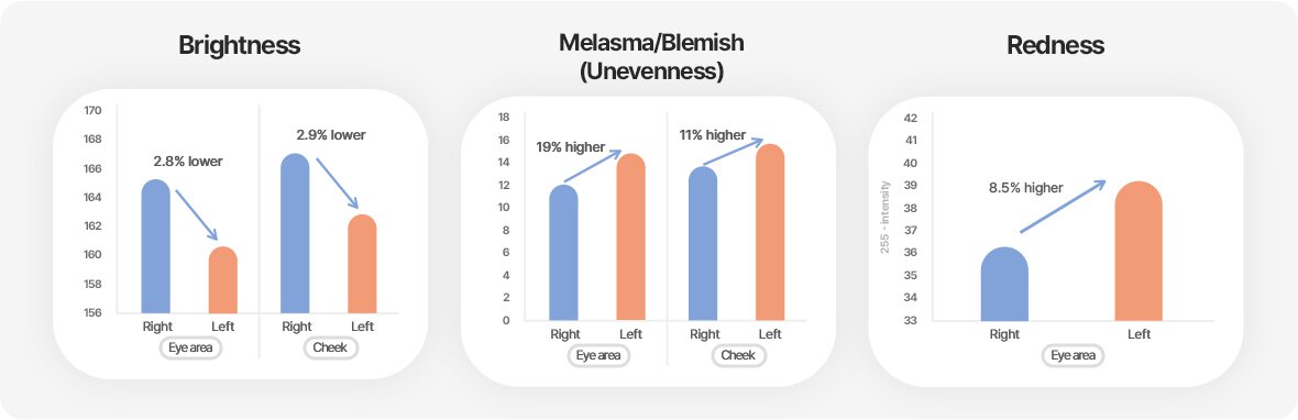 Brightness, Melasma/Blemish (Unevenness), Redness