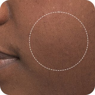 Close-up of a participant’s cheek before use of Laneige hydrating sleeping mask, showing visible texture and uneven tone.