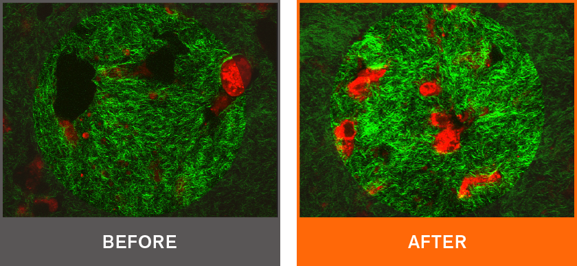 Before and after microscopic images showing skin collagen damage and repair after 48 hours of GINSENOMICS treatment
