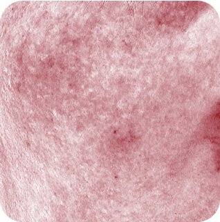 Close-up of facial skin before using Laneige hydrating sleeping mask, showing visible redness and irritation.