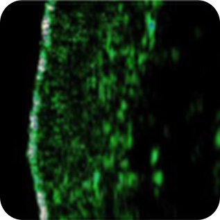 Trước, Skin Firmness