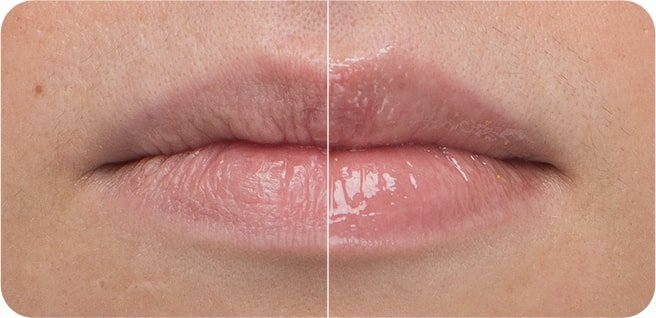 Model's lips before and after using 'BOUNCY & FIRM LIP TREATMENT' shows a visible improvement in plumpness and smoothness.