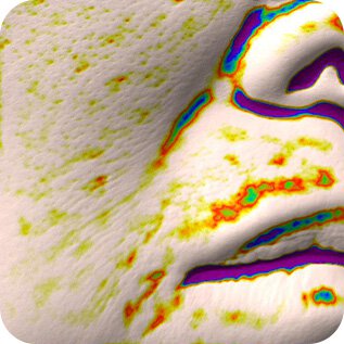 Trước, Smile Lines