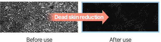 Dead skin reduction of before/after use
