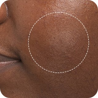 Close-up of a participant’s cheek after use of Laneige hydrating sleeping mask, appearing smoother and more radiant.