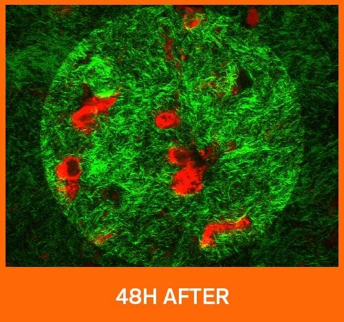 Microscopic skin image 48 hours after applying Sulwhasoo Concentrated Ginseng Renewing Cream EX, showing visibly improved collagen density and restored skin condition.