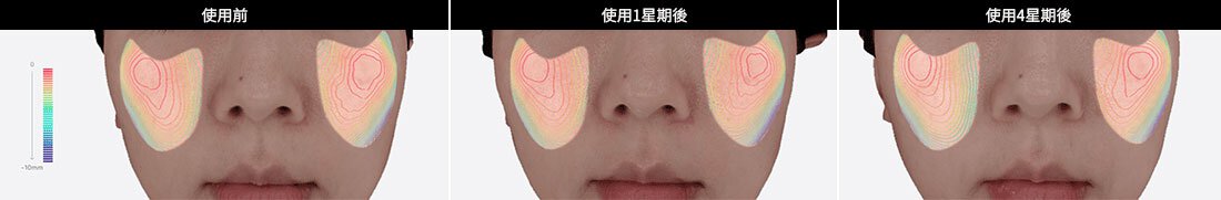 使用前 / 使用1星期後 / 使用4星期後