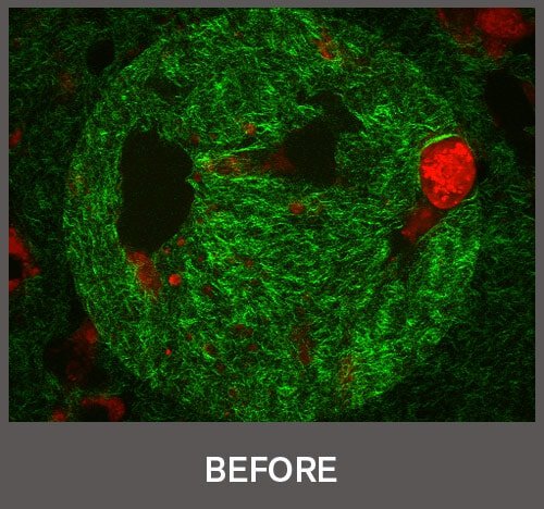 Microscopic skin image before use, showing UV-damaged aged skin with weakened collagen structure in red and green tones.