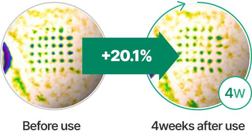 Before use +20.1% 4weeks after use