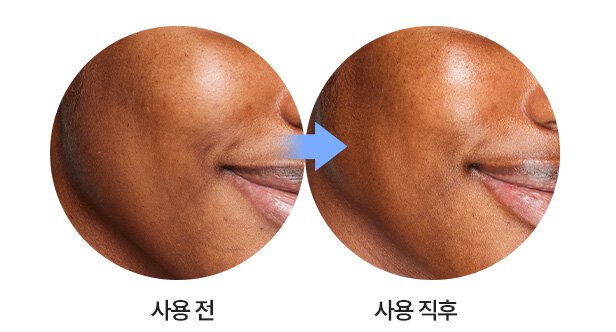 크림 스킨 세라펩타이드 리파이너 사용 전/후 피부 윤기 차이