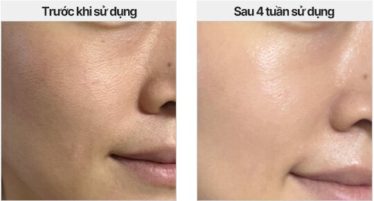 Skin Glow Improvement / Before use / After 1 day