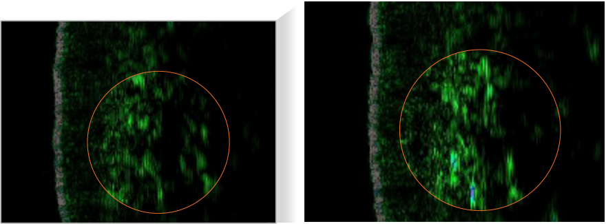 微觀影像展示雪花秀 Ultimate S Infusion Treatment 在肌膚中的加強吸收，突顯產品在深層保濕與煥活肌膚方面的功效。