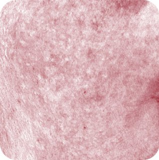 使用蘭芝水庫睡眠面膜後的肌膚特寫，顯示泛紅現象減少，改善幅度達-13.1%。