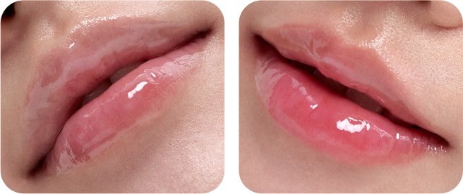 After applying LANEIGE LIP GLOWY BALM TARO BUBBLE TEA for smooth, glossy lips, showing a hydrated, natural color.