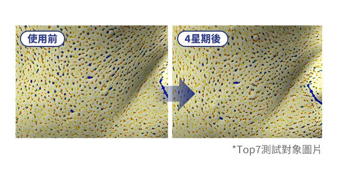 使用前 4星期後 *Top15測試對象圖片