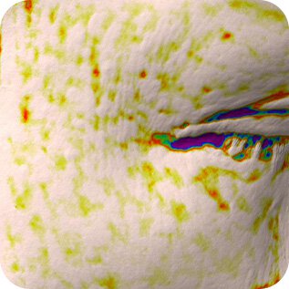 Sau 4 tuần. of use, Anti-wrinkle Effect in Eye Area