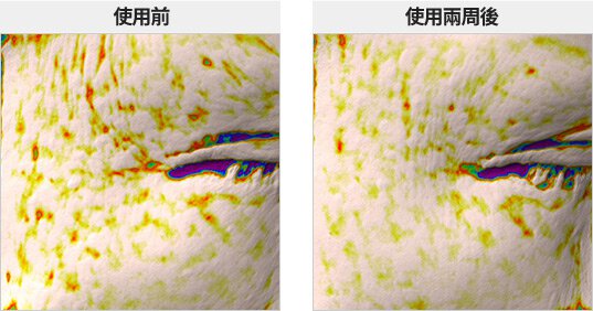 anti-wrinkle effect/Perfect Renew 3X Perfect Renew 3X Emulsion