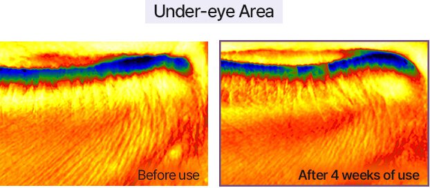 Under-eye Area